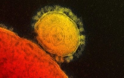 В Китае ученые обнаружили новый вирус, вызывающий пневмонию