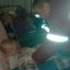 Двое детей пострадали при пожаре в Светлогорске