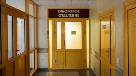Мужчина получил ожоги при пожаре в Щучинском районе