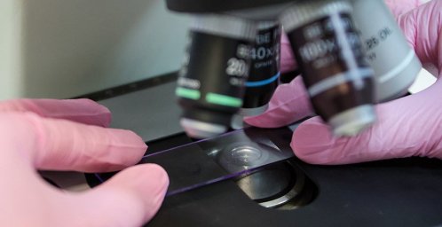 Разработан антибактериальный гель на основе лишайников для заживления ран