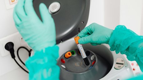 Повышенное содержание углекислого газа выявили в крови современных людей