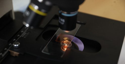 Уникальный белорусский биочип для аллергодиагностики проходит регистрационные испытания