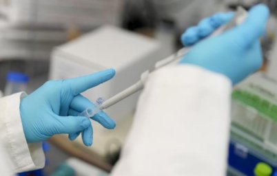Открыта ранее неизвестная форма эпилептической активности